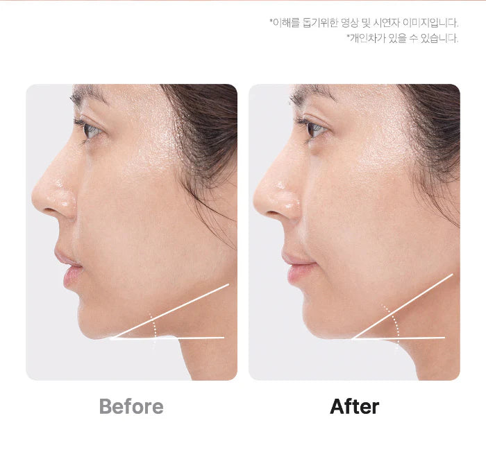 VioraLift Pro™ Microcurrent Facial Toning Device - Lift, Firm & Sculpt
